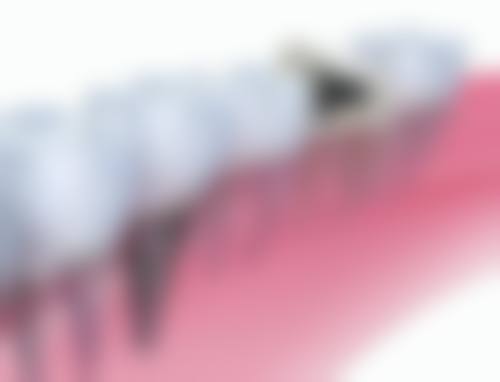 云南丽江宁蒗紫玛口腔常见问题FAQ