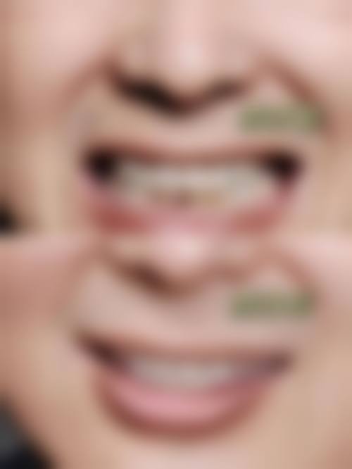 呼伦贝尔鑫富强口腔擅长项目