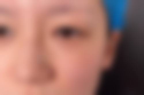 武汉艾美整形医院擅长项目