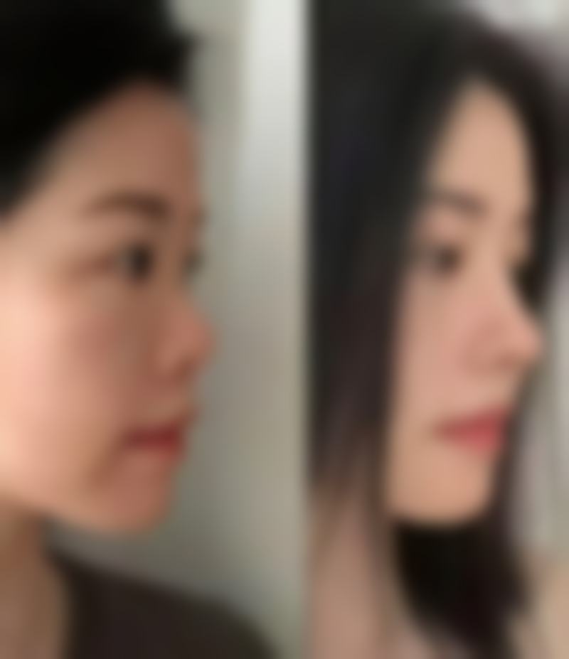 吴昌铉医生真实患者口碑评价