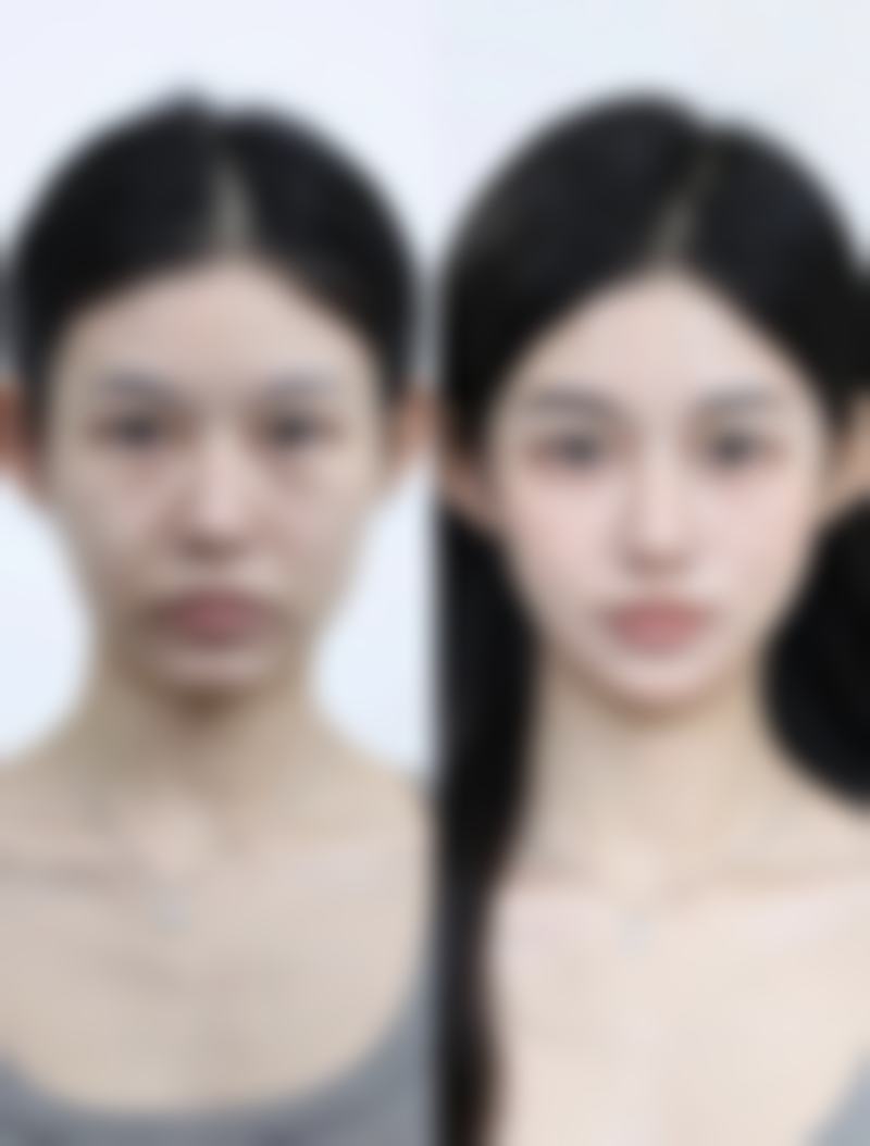吴昌铉擅长面部轮廓与五官精细化整形