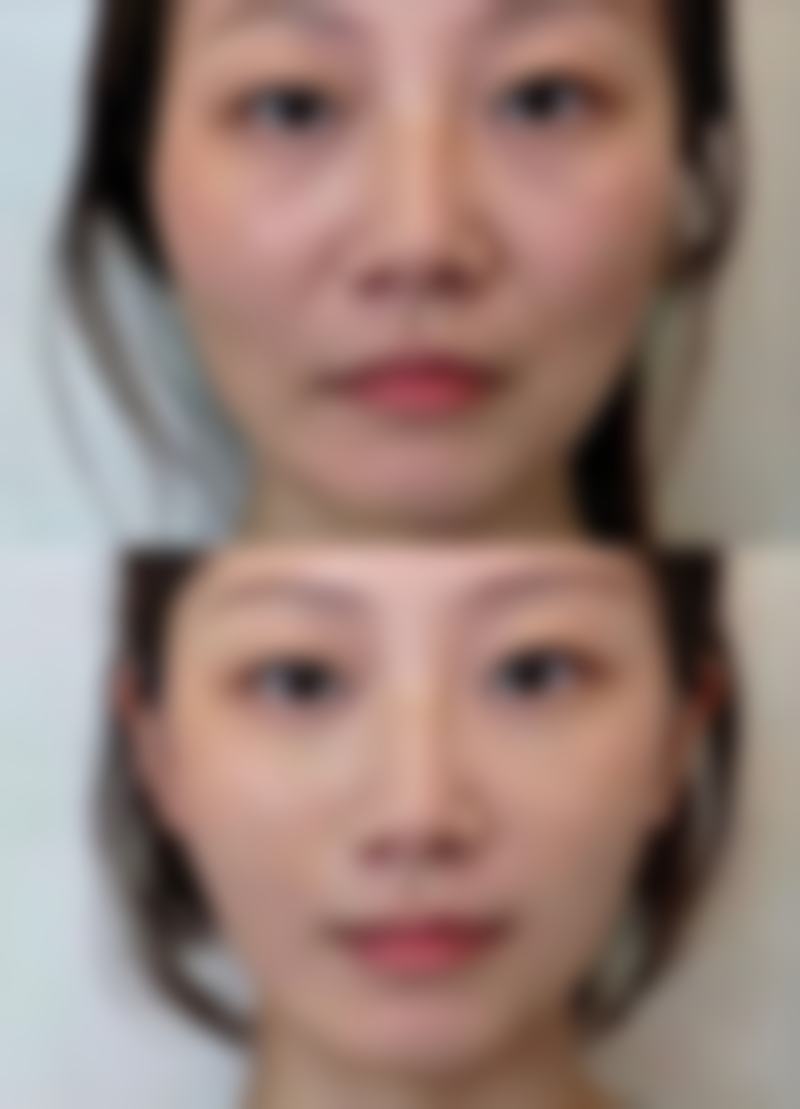 深圳乐思美整形医院地址交通与口碑评价