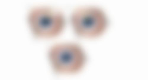 总结