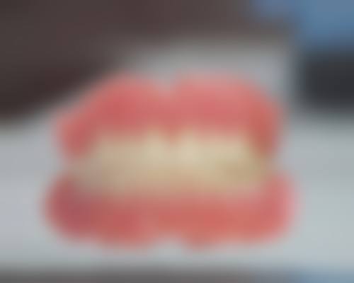 柳州牙丽安口腔门诊部高频就医疑问解答