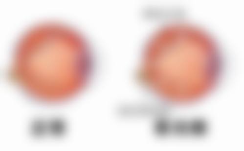 福州希玛林顺潮眼科门诊部医生团队专精度解析