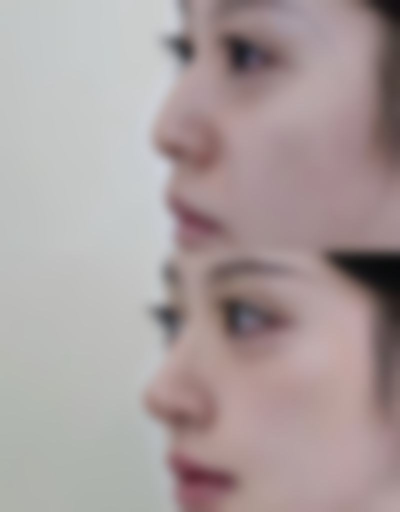 渭南蓓蕾斯特医疗美容门诊部怎么预约?