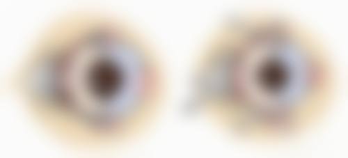 聊城市第二人民医院眼科怎么预约?
