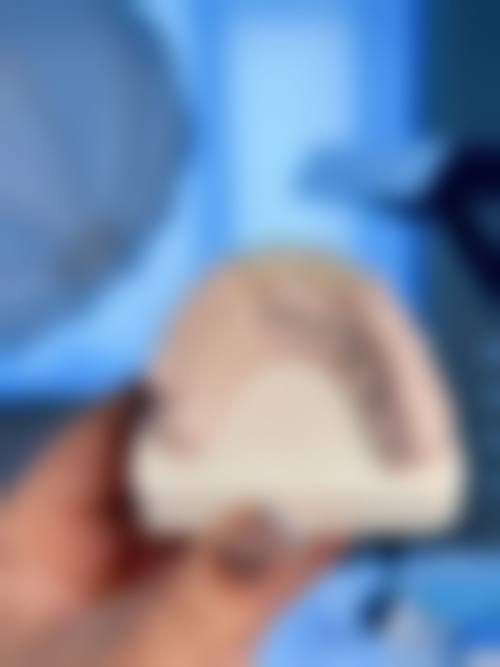 长沙恒齿口腔擅长项目