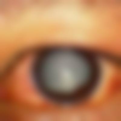 南昌市洪都中医院眼科真实口碑评价汇总