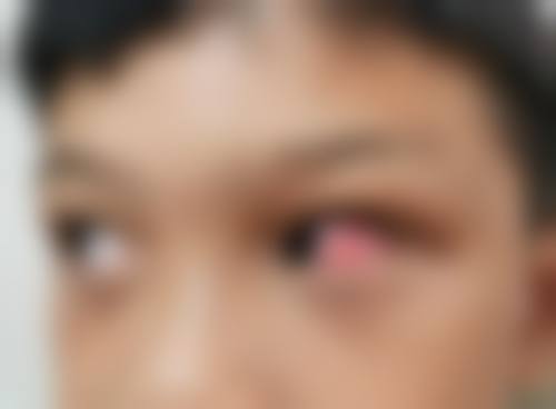 2026江西省人民医院眼科价格表(仅供参考)