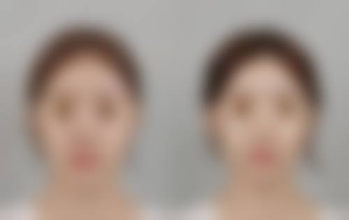 Dr孙维那医院价格表