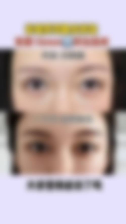 2026厦门思明荟美天成整形外科价格表(仅供参考)