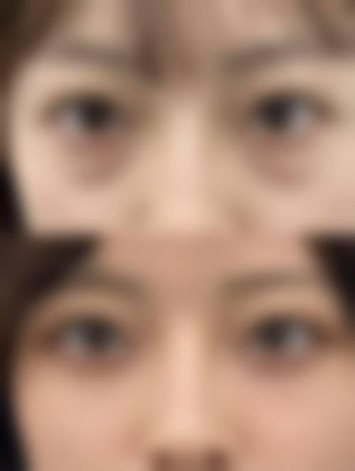 总结