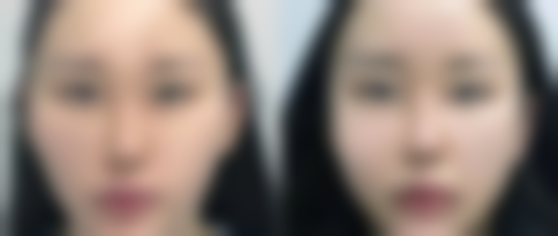 厦门思明荟美天成整形外科常见问题FAQ