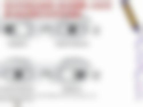 真实实例分享:做完蔡司SMILE4.0后的视力与生活变化
