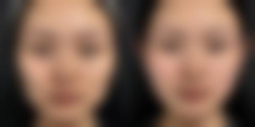 景德镇亚菲医疗美容就医快问快答