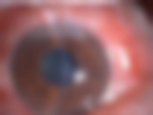 黑龙江省牡丹江林业中 心医院眼科预约挂号方式