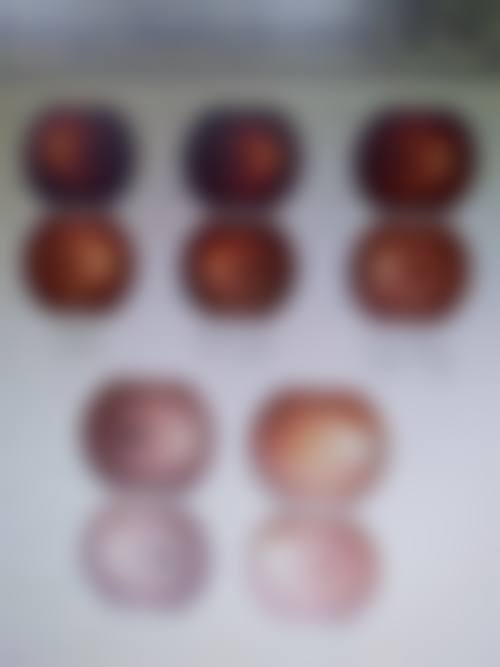陈婉珠擅长哪些核心眼科项目