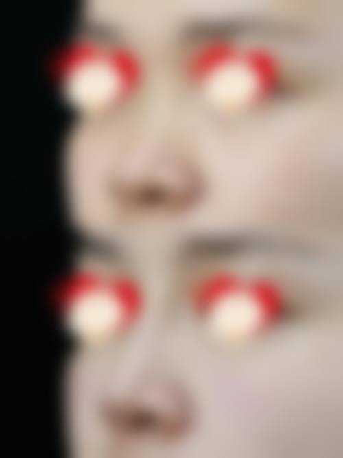 总结